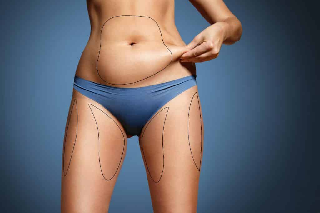 How Much Does SmartLipo Cost?