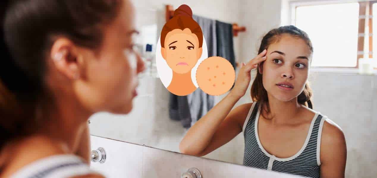 Pores Clogged With Hard Sebum – How To Deal With Sebum Plugs