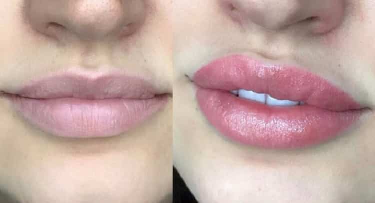 Quick Guide to Microblading Lips