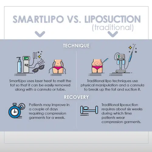 SmartLipo vs Lipo